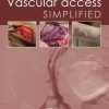 Vascular Access Simplified; second edition eBook