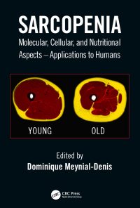 Sarcopenia: Molecular, Cellular, and Nutritional Aspects eBook