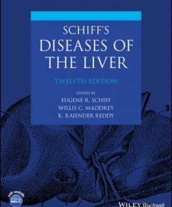 Schiff's Diseases of the Liver eBook