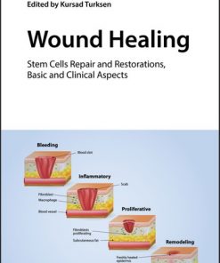 Wound Healing: Stem Cells Repair and Restorations, Basic and Clinical Aspects eBook