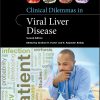 Clinical Dilemmas in Viral Liver Disease eBook