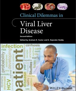 Clinical Dilemmas in Viral Liver Disease eBook