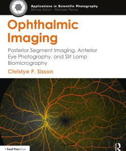 Ophthalmic Imaging: Posterior Segment Imaging, Anterior Eye Photography, and Slit Lamp Biomicrography eBook
