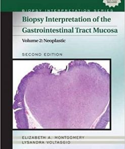 Biopsy Interpretation of the Gastrointestinal Tract Mucosa: Volume 2: Neoplastic eBook