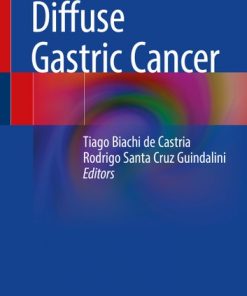 Diffuse Gastric Cancer eBook