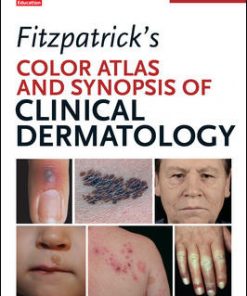 Fitzpatrick's Color Atlas and Synopsis of Clinical Dermatology, Seventh Edition eBook