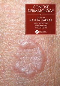 Concise Dermatology eBook