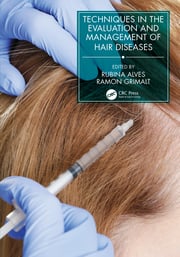 Techniques in the Evaluation and Management of Hair Diseases eBook