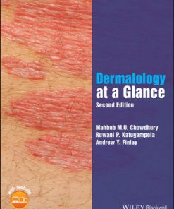 Dermatology at a Glance eBook