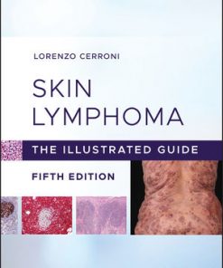 Skin Lymphoma: The Illustrated Guide eBook