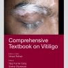 Comprehensive Textbook on Vitiligo eBook