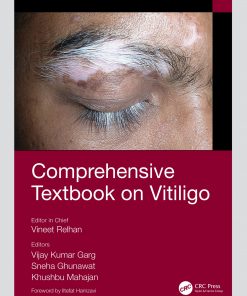 Comprehensive Textbook on Vitiligo eBook