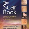 The Scar Book: Formation, Mitigation, Rehabilitation and Prevention eBook