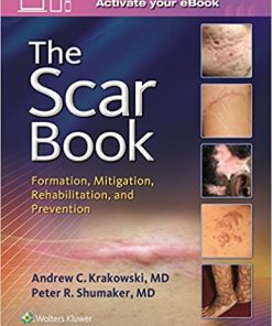 The Scar Book: Formation, Mitigation, Rehabilitation and Prevention eBook