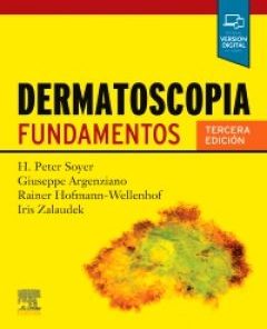 Dermatoscopia: Fundamentos eBook