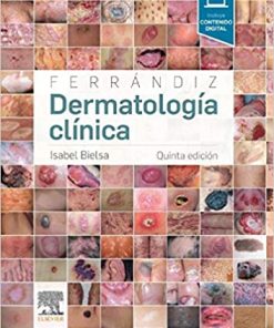 Ferrándiz. Dermatología clínica eBook