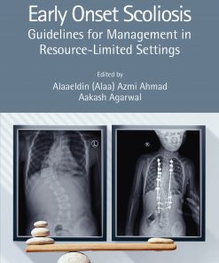 Early Onset Scoliosis: Guidelines for Management in Resource-Limited Settings eBook
