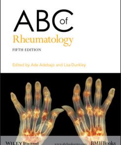 ABC of Rheumatology eBook