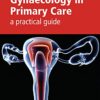 Gynaecology in Primary Care: A Practical Guide eBook