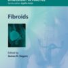 Fibroids eBook