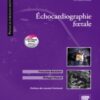 Echocardiographie fœtale eBook