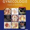 Gynécologie eBook