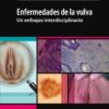 Enfermedades de la vulva eBook