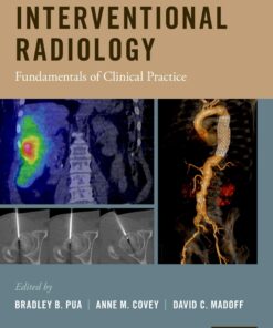 Interventional Radiology: Fundamentals of Clinical Practice eBook