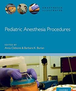 Pediatric Anesthesia Procedures eBook