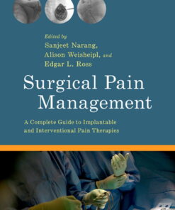 Surgical Pain Management: A Complete Guide to Implantable and Interventional Pain Therapies eBook