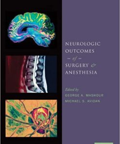 Neurologic Outcomes of Surgery and Anesthesia eBook