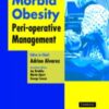 Morbid Obesity eBook