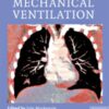 Core Topics in Mechanical Ventilation eBook