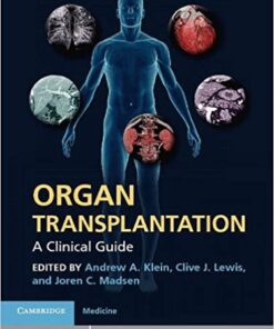 Organ Transplantation: A Clinical Guide eBook