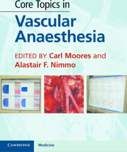 Core Topics in Vascular Anaesthesia eBook
