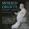 Morbid Obesity: Peri-operative Management eBook