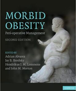 Morbid Obesity: Peri-operative Management eBook