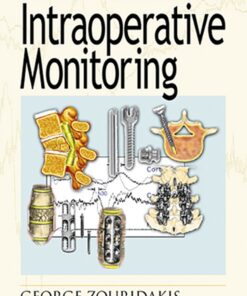 A Concise Guide to Intraoperative Monitoring eBook