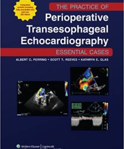 The Practice of Perioperative Transesophageal Echocardiography: Essential Cases eBook