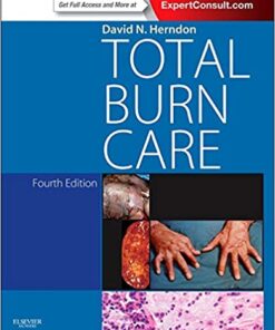 Total Burn Care: Expert Consult - Online eBook
