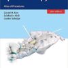 Epiduroscopy eBook