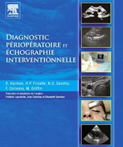 Diagnostic périopératoire et échographie interventionnelle avec DVD en anglais eBook