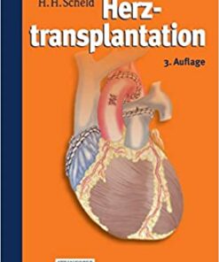 Leitfaden Herztransplantation eBook