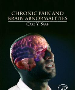 Chronic Pain and Brain Abnormalities eBook