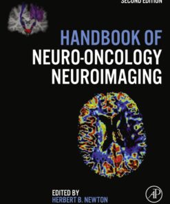 Handbook of Neuro-Oncology Neuroimaging eBook