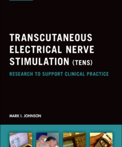 Transcutaneous Electrical Nerve Stimulation (TENS): Research to support clinical practice eBook