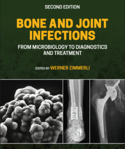 Bone and Joint Infections: From Microbiology to Diagnostics and Treatment eBook
