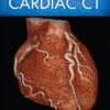 The Complete Guide to Cardiac CT eBook
