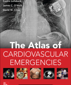 Atlas of Cardiovascular Emergencies eBook