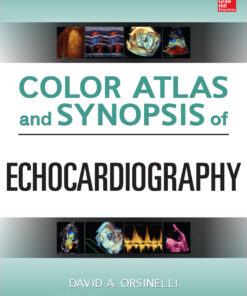Color Atlas and Synopsis of Echocardiography eBook